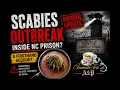 Scabies Outbreak Reported Inside NC Prison Inmate Speaks Out