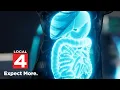 Understanding risks of GLP-1 weight loss drugs