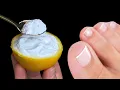 Instantly removes nail fungus like an eraser The best natural remedy 100 efficiency