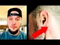 BIG UPDATE On The Lump Found Behind My Ear