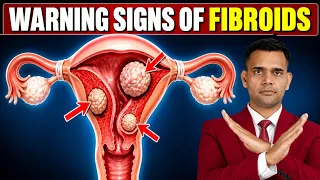 Uterine Fibroids : 5 Warning Signs You Shouldn’t Ignore