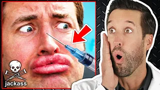 ER Doctor REACTS to CRAZY Jackass Best and Last Injuries