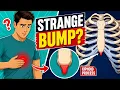 Xiphoid Process Explained Lump Pain CPR Safety