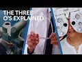 Ophthalmologists Optometrists and Opticians - What s The Difference
