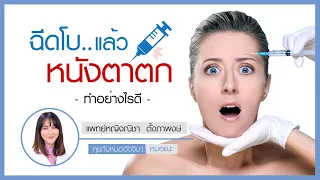  อาการเปลือกตาลืมไม่ขึ้นหลังฉีดโบท็อกซ์ เกิดจากอะไร และจะหายได้อย่างไร 