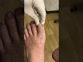 Download Lagu Look how easy this toenail comes off! 😳🤯 #shorts #nails
