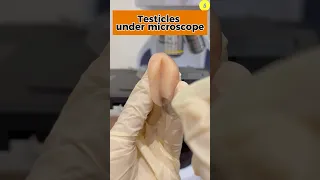 How Sperm Are Produced Under A Microscope TULO Microscope Sperm Testicles Microscope Shorts 