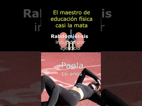 EL EJERCICIO EXTENUANTE PUEDE CAUSAR LA MUERTE