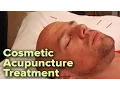 Cosmetic Facial Acupuncture Treatment Improve Skin Tone Reduce Wrinkles Naturally
