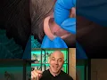 Download Lagu Derm reacts to a very hairy ear-piercing removal! #dermreacts #doctorreacts #earpiercing