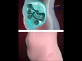 Download Lagu TWINS STRUGGLING TO SURVIVE INSIDE THE WOMB (3D ANIMATION)