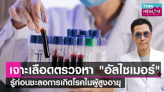  ทำไมผู้สูงอายุถึงมีความเสี่ยงต่อการหกล้ม และเกิดเหตุการณ์นี้บ่อยแค่ไหนในแต่ละปี 