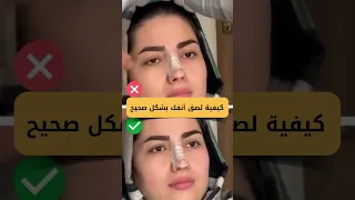 طريقة وضع لصقات الانف بعد التجميل  تجميل الأنف  تجميل دندنها