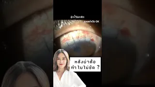  ทำไมคนไข้ที่เพิ่งผ่าตัดต้อกระจกมา 1 วัน ถึงยังมองไม่เห็นอะไรเลย 