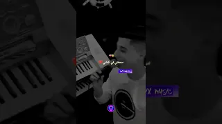 Cheb Anouar Mignon 𝚂𝚊3𝚊𝚏𝚝𝚊𝚔 𝙲𝚑𝚑𝚊𝚕 𝚈𝚊 𝙶𝚊𝚕𝚋𝚒 