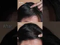 Download Lagu Loreal Paris magic Retouch #greyhair #hairspray #lorealparis #beforeandafter #shortsfeed