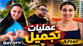 عملية تجميل الأذن👂🏻قبل وبعد..ما كنتش متوقع هاد النتيجة😱