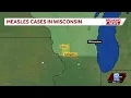 Wisconsin confirms two new measles cases in Iowa Lafayette counties