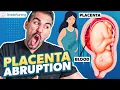 Placental Abruption Symptoms Causes Nursing Interventions NCLEX Tips
