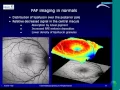 An Overview of BluePeak Autofluorescence and its Use in a Clinical Setting