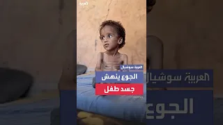 مشهد لطفل أنهكت جسده حرب التجويع في قطاع غزة إلى جانب حرب القصف والرصاص والتشريد  مشهد لطفل أنهكت جسده حرب التجويع في قطاع غزة إلى جانب حرب القصف والرصاص والتشريد