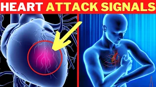 Download 1 Month Before a Heart Attack, Your Body Will Give These Signs MP3