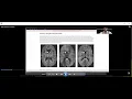 dMRI analysis in Python