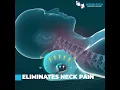 Neck Cloud Cervical Traction Device