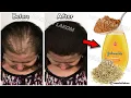 Download Lagu Put these ingredients in your shampoo, 🧅 it accelerates hair growth and treats baldness