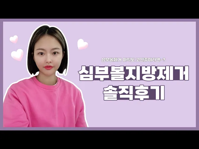 심부볼지방제거 솔직후기 아직  안보셨다구요?