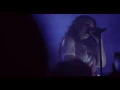 Alessia Cara - Scars To Your Beautiful (Vevo Presents)