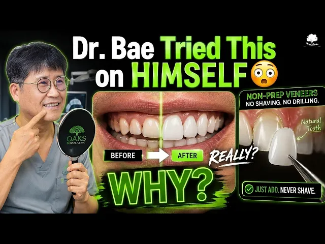 Dr. Bae Tried Non-Prep Veneers on Himself 😳🦷 Here's What He Learned