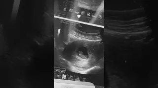 حالات واتس يابعد عمري للحامل 