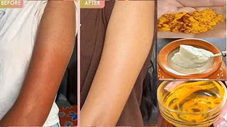 1 बार लगाने से ही दिखेगा फर्क - स्किन की सारी प्रॉब्लम हमेशा के लिए खत्म - Body Glowing at Home