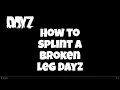 Fractured Leg in DayZ Here s How to Heal It Fast