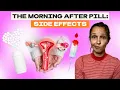 The Morning After Pill Side Effects Julie