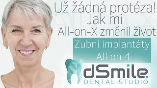 Z protézy k dokonalému úsměvu: můj příběh s All-on-X na klinice Dsmile v Praze