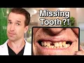 Best way to replace a MISSING TOOTH tooth replacement options