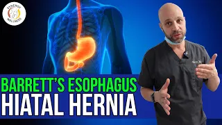 Patient with Barrett s Esophagus and Hiatal Hernia
