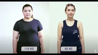 ภาวะมีบุตรยากที่เกิดจากอ้วนส่งผลต่อการตัดสินใจผ่าตัดอย่างไร