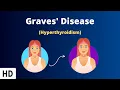 Graves Disease Everything You Need To Know