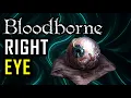Can I Beat Bloodborne Using Only My Right Eye