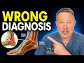 Tarsal Tunnel Syndrome The Diagnosis Millions Have and Nobody Catches