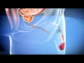 Sex Reassignment Surgery