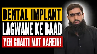 Kya Dental Implant Kharab Ho Sakta Hai? - Dental Implant Failure Reasons - Dental Care Tips