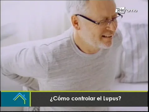 ¿Cómo controlar el Lupus?