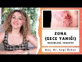 Download Lagu Zona (Gece Yanığı) Neden Olur? Nasıl Tedavi Edilir?