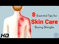 8 Shingles Skin Care Hacks for Quick Relief
