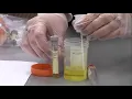Urine Specimen Collection