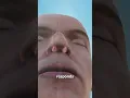 What Causes A Stuffy Nose